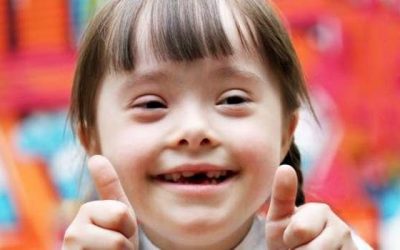 Should a person with Downs Syndrome be baptized?